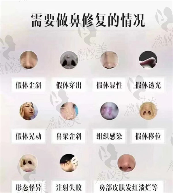 鼻修復(fù)的幾種情況