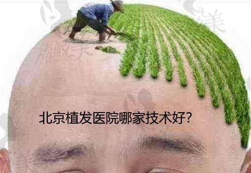 北京植发医院哪家技术好