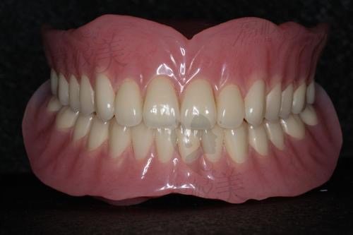 牙齿缺失的修复方式吸附性义齿