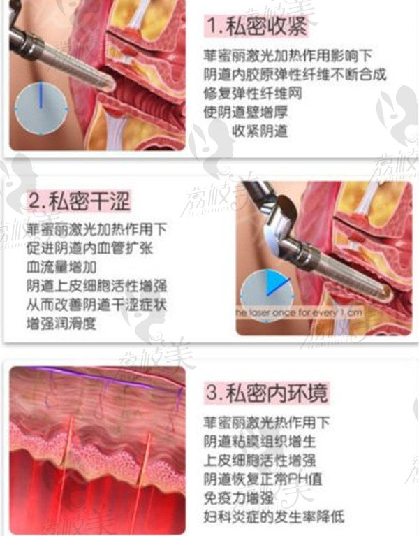 菲蜜丽抵抗老龄化原理