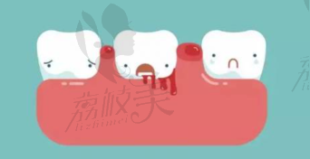 牙体牙髓病治疗项目介绍
