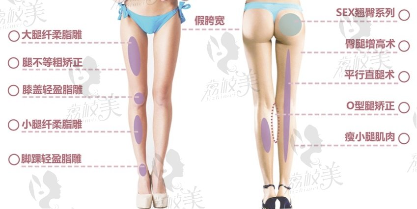 北京樱桃医美直腿术能解决的问题