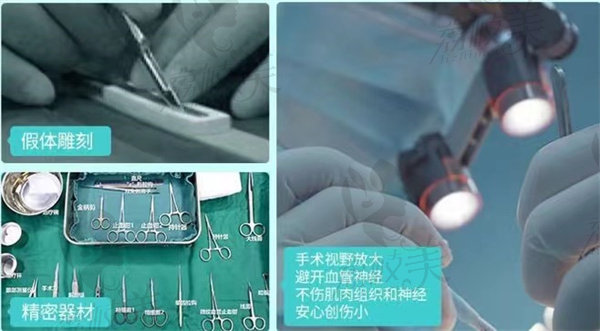 广州紫馨手术过程