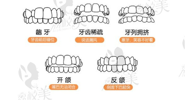 南昌德韓隱適美隱形矯正