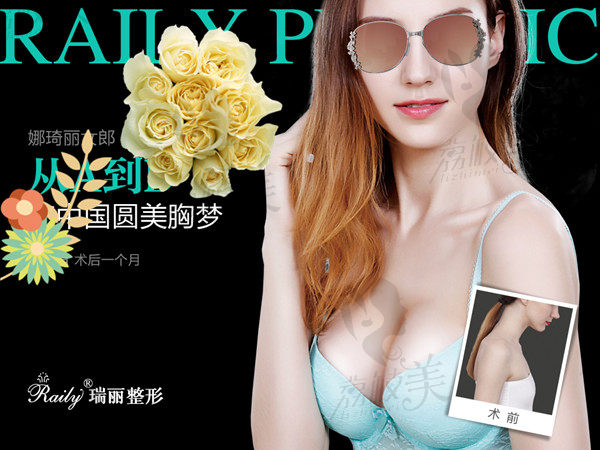 感谢瑞丽整形对我的改变