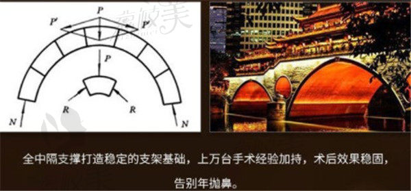 原生肋骨鼻支撑特点