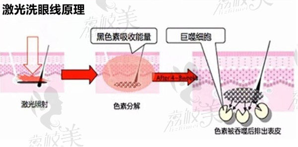 洗眼线原理