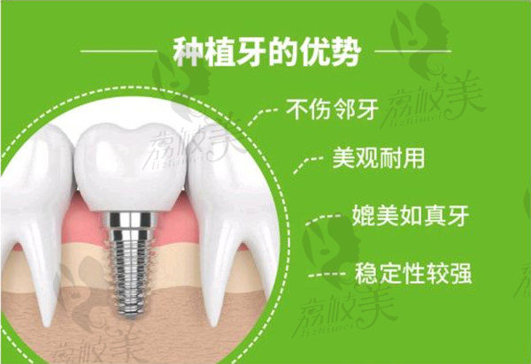 上海英博口医院种植牙优势