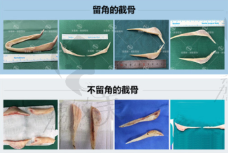 北京圣嘉新下頜成角截骨術(shù)