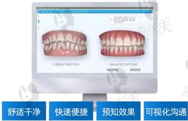 上海美奥牙齿矫正优势