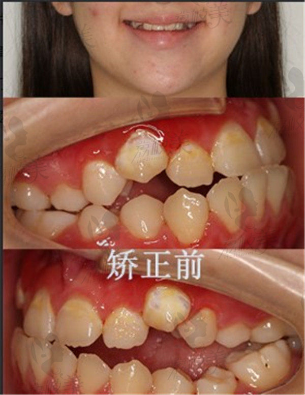 术前的我
