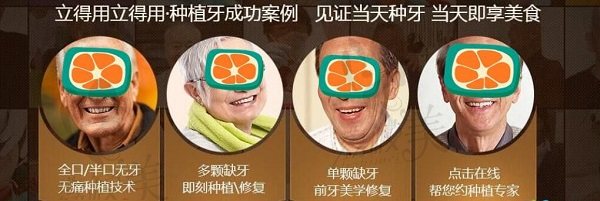 西安中诺种植牙