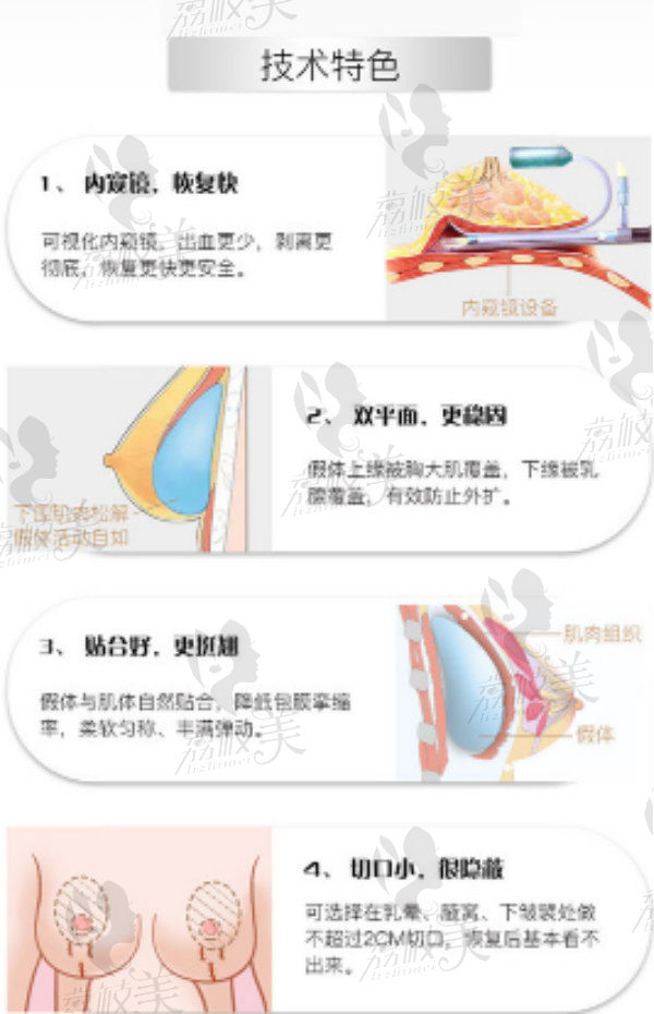 鄭州維美斯整形醫(yī)院隆胸技術(shù)特色