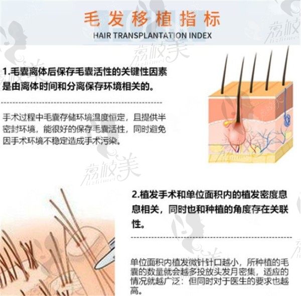 贵阳丽都毛发移植指标