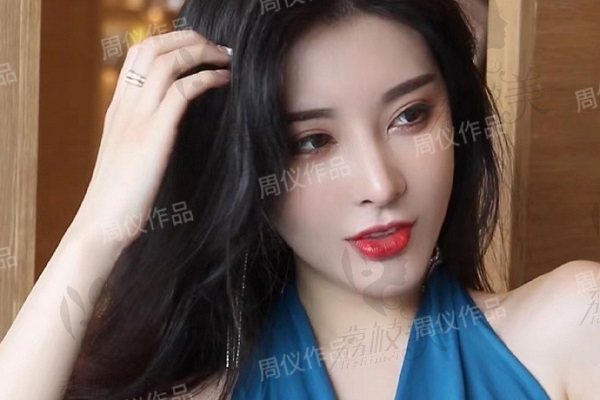 成都儀美美仁周儀醫(yī)生隆鼻