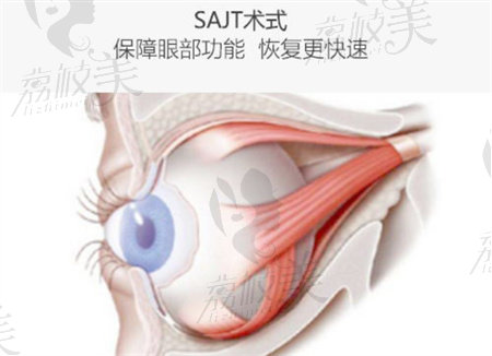 眼部修复手术