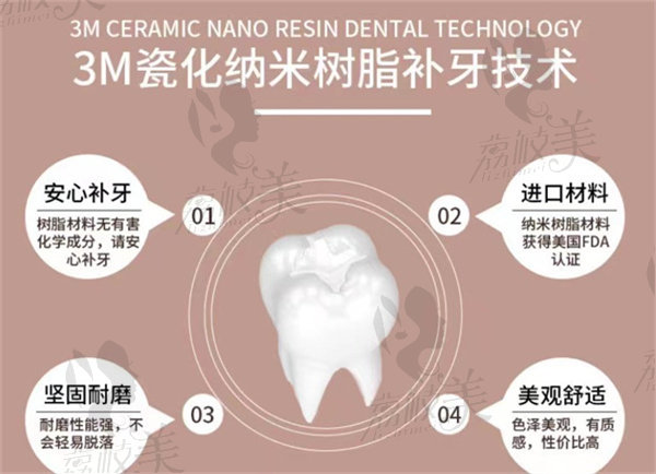 3M瓷化纳米树脂补牙技术
