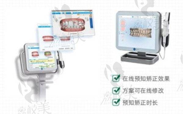 上海圣贝牙齿矫正3D口扫仪