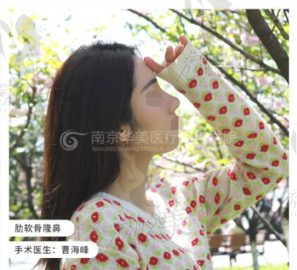 南京华美整形术后照片