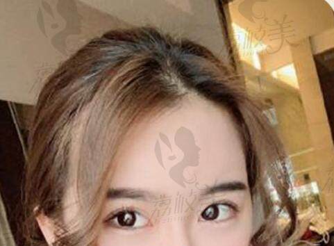 南京康美整形术后照片