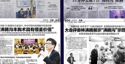 沸腾沟丰胸术相关报道