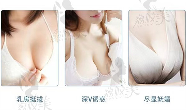 泰州丽都整形隆胸照片