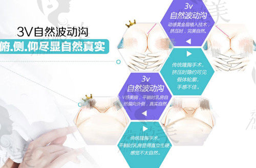 广州荔湾区人民医院胸部整形优势