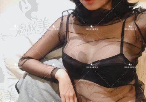 南京美莱夏建军隆胸术后