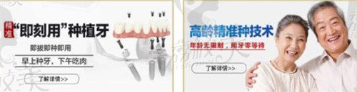 广州广大口腔种植牙优势