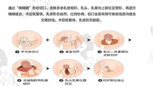 栗勇缩胸技术怎么样