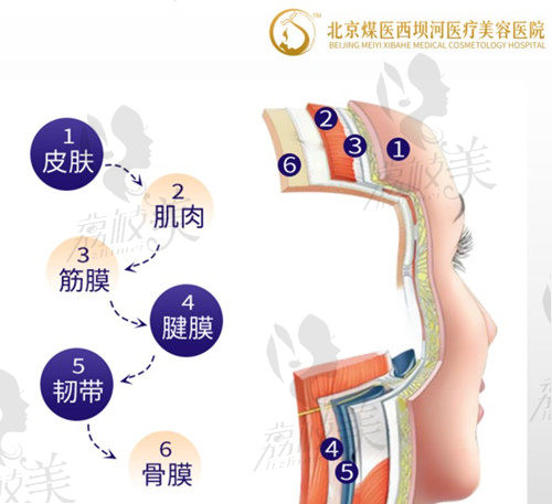 北京煤医拉皮原理