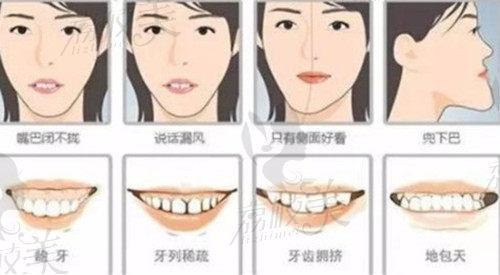 杭州格莱美口腔牙齿矫正可提升的颜值