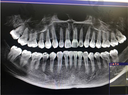 上海悦康口腔口腔清洁