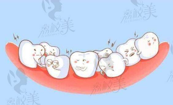 牙齿矫正的危害