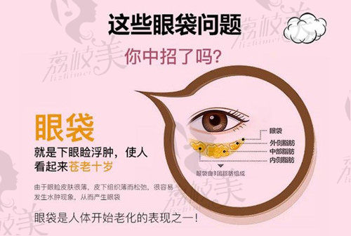 深圳做眼袋手术哪个医院比较好？揭秘深圳做眼袋好的医生及价格