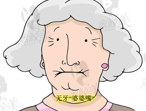 牙龈萎缩提前变成婆婆嘴