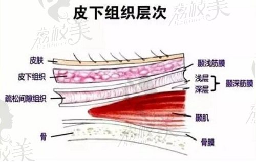 王志军除皱术皮下组织层次