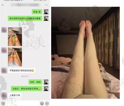 北京达美如艺医疗美容腿部吸脂