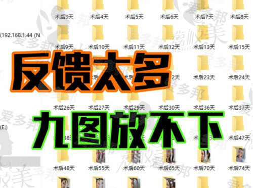王绍国取生长因子术后反馈