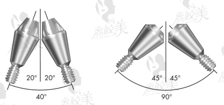 瑞典astra种植体