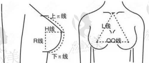 萬連壯院長隆胸審美理念