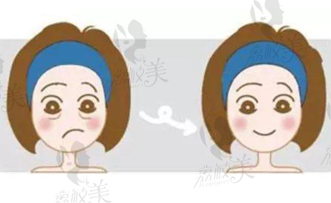 北京八大处北院眼部整形