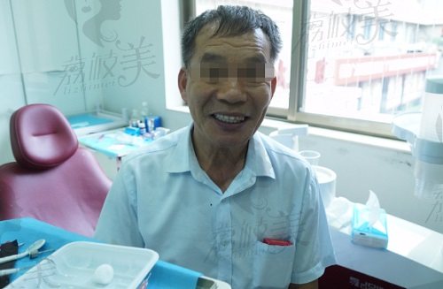 广州广大口腔医院种植牙术后