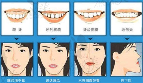 张医生牙齿矫正可解决的问题