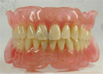 牙齿修复手术.jpg