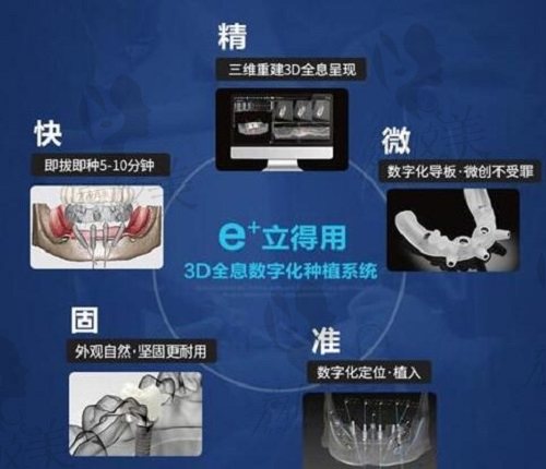 北京中诺口腔医院立得用种植牙系统