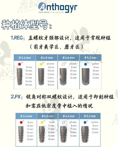 法国安卓健种植牙型号