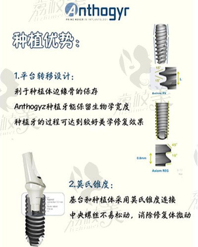 法国安卓健种植牙优势