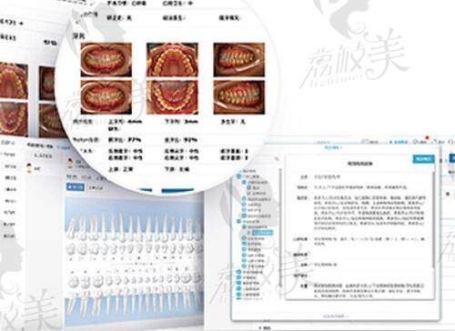 深圳乐莎莎口腔多维度定制矫正方案