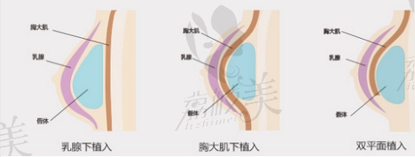 北海韩美整形